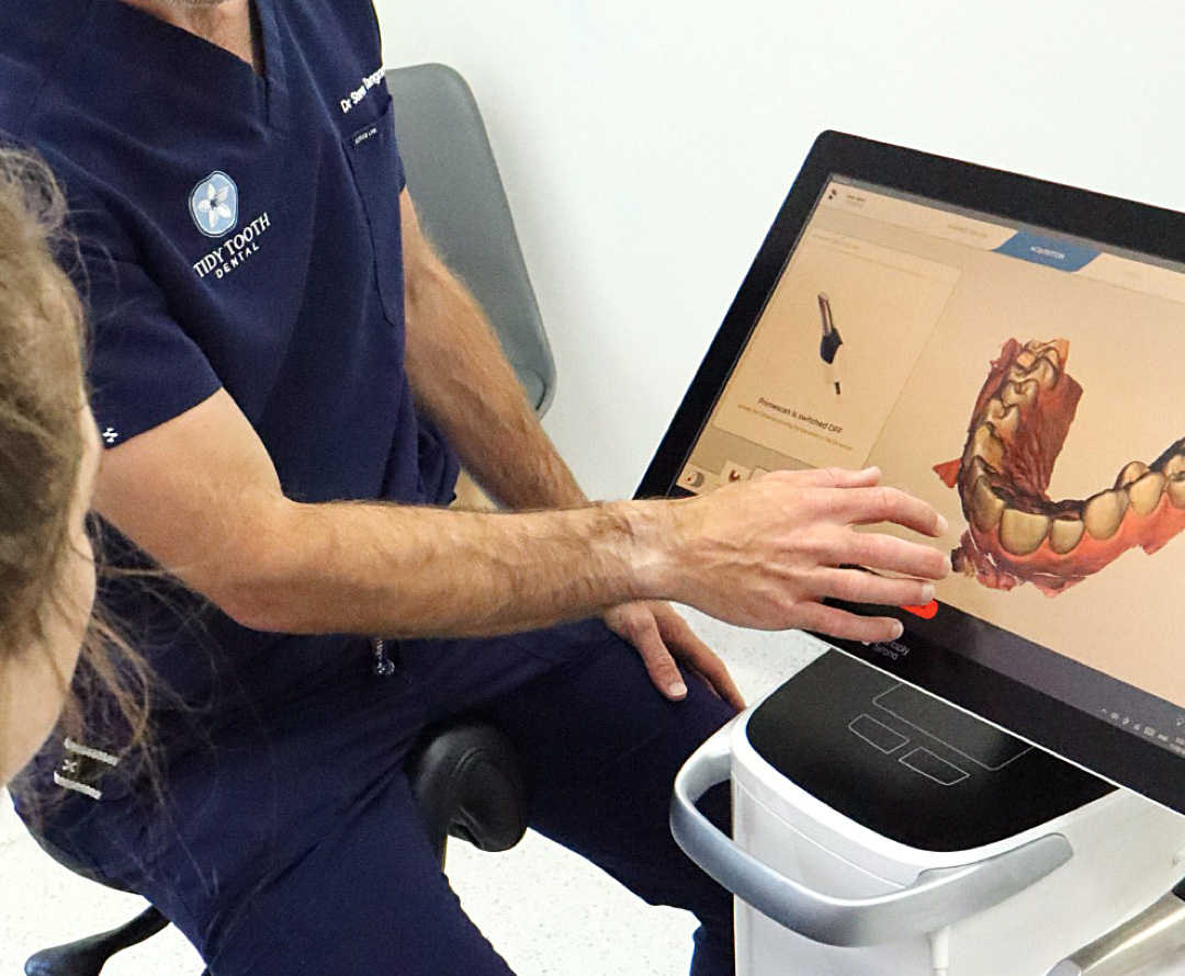 Dental Implants Batemans Bay Tidy Tooth Dental 